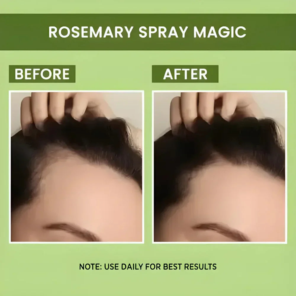 Rosemary Water Spray | For Hair Regrowth (Buy 1 Get 2 Free đ)